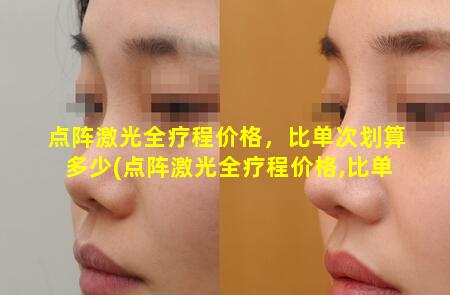 点阵激光全疗程价格，比单次划算多少(点阵激光全疗程价格,比单 💮 次划算多少)